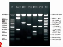 五种致泻性大肠埃希氏菌多重PCR检测试剂盒